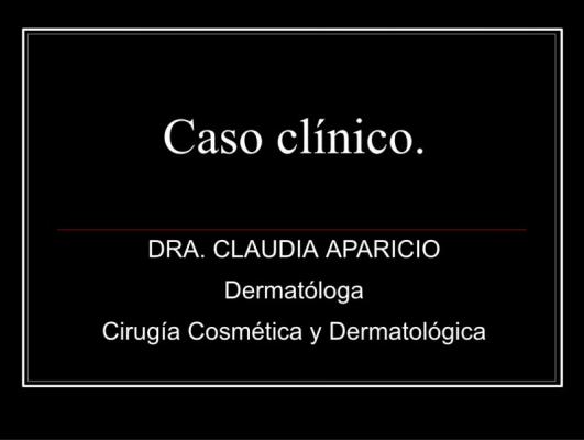 Caso Clínico de Psoriasis pustulosa de palmas y plantas