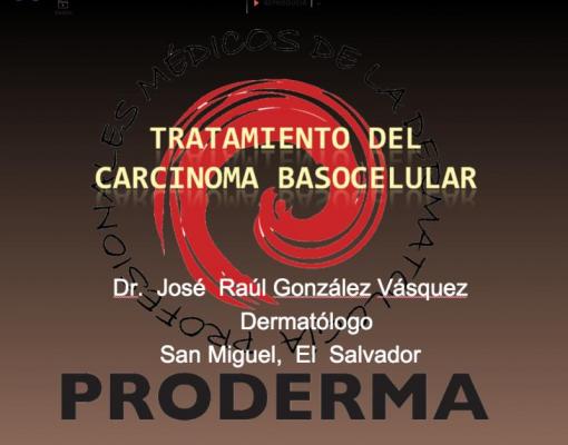 Tratamiento del Carcinoma Basocelular