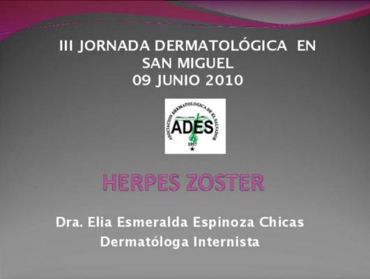Herpes Zoster