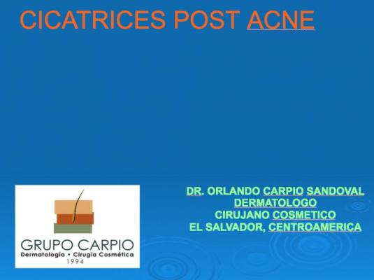 Peelings Químico en el Tratamiento de las Cicatrices post acné